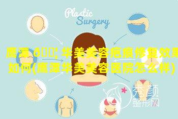 鹰潭 🐦 华美美容疤痕修复效果如何(鹰潭华美美容医院怎么样)